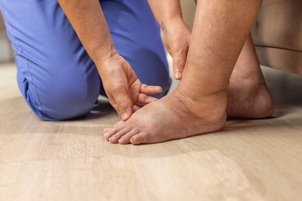 A multidiszciplináris szemlélet szerepe a nyiroködéma kezelésében